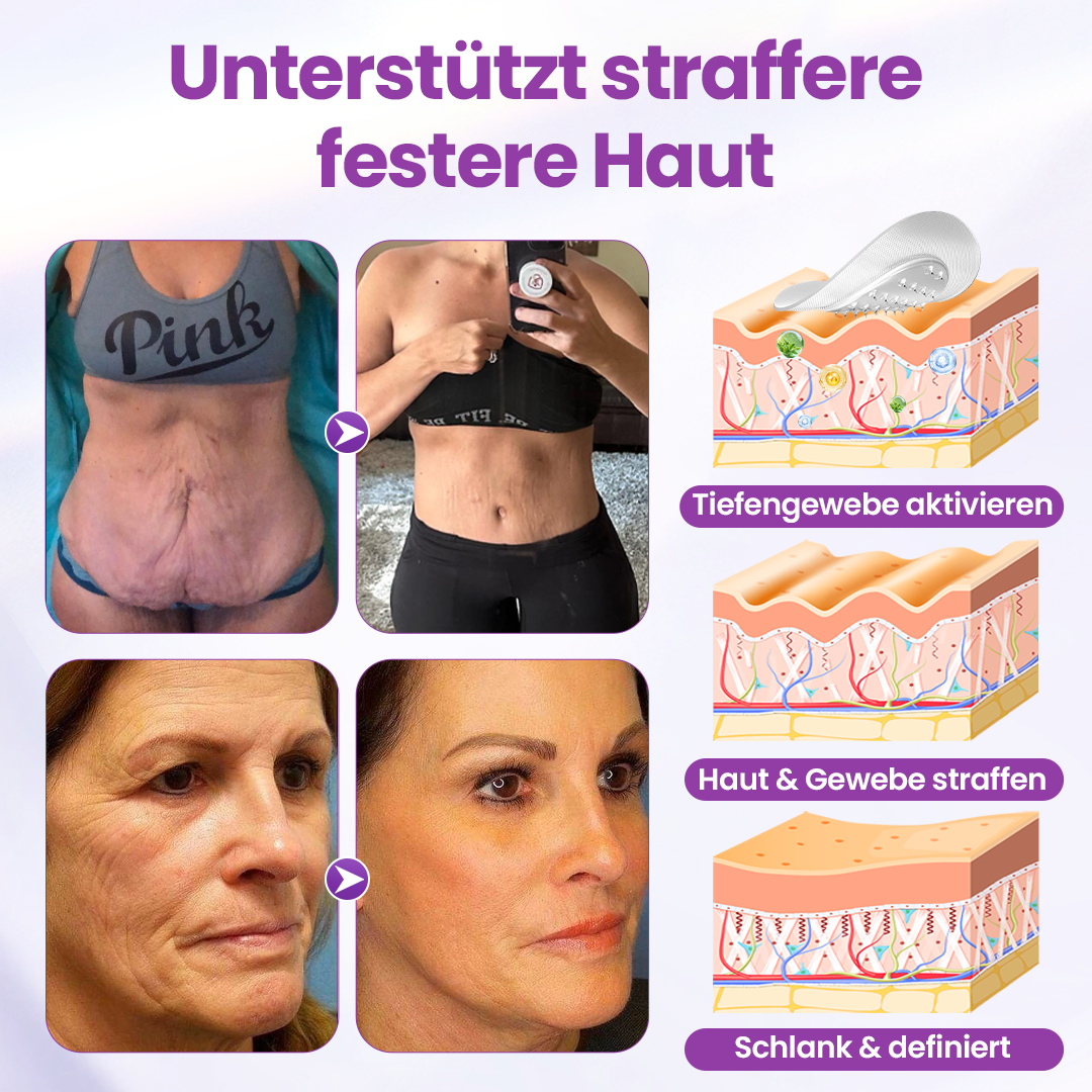 Timilk® Nano-Mikro-Delivery Slim Patch — Moringa · Berberin × NAD+ 10-in-1