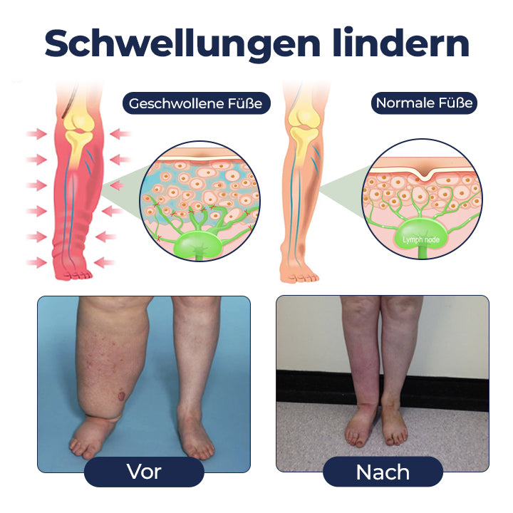 Timilk® SwellRelief Durchblutungsunterstützende Creme⭐