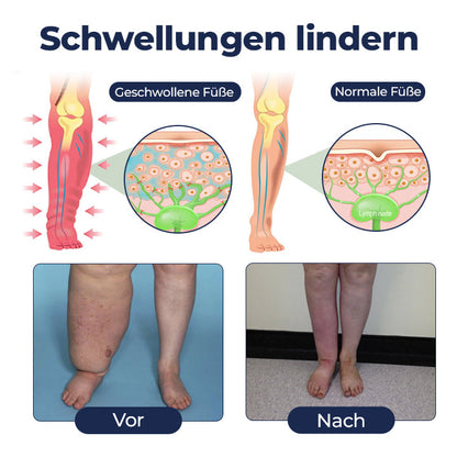 Timilk® SwellRelief Durchblutungsunterstützende Creme⭐