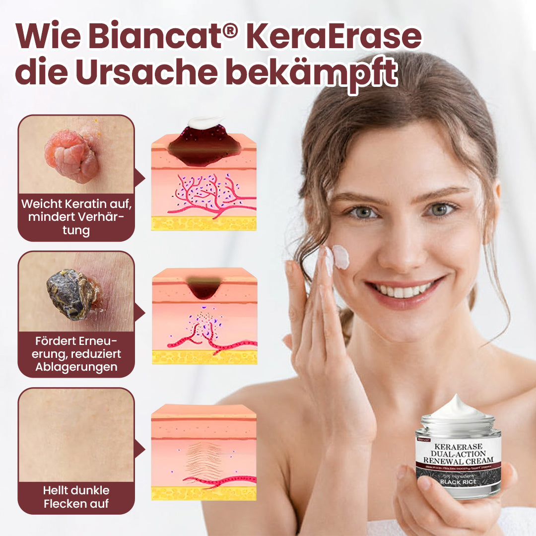 Biancat® KeraErase Dual-Action Erneuerungscreme⭐