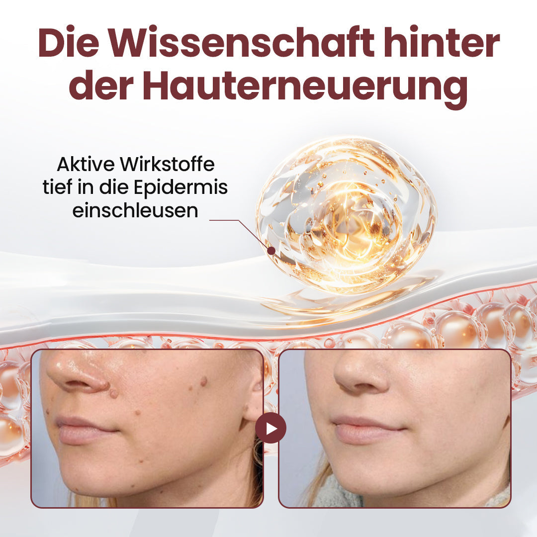 Biancat® KeraErase Dual-Action Erneuerungscreme