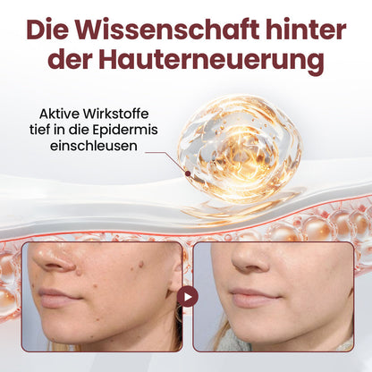 Biancat® KeraErase Dual-Action Erneuerungscreme⭐