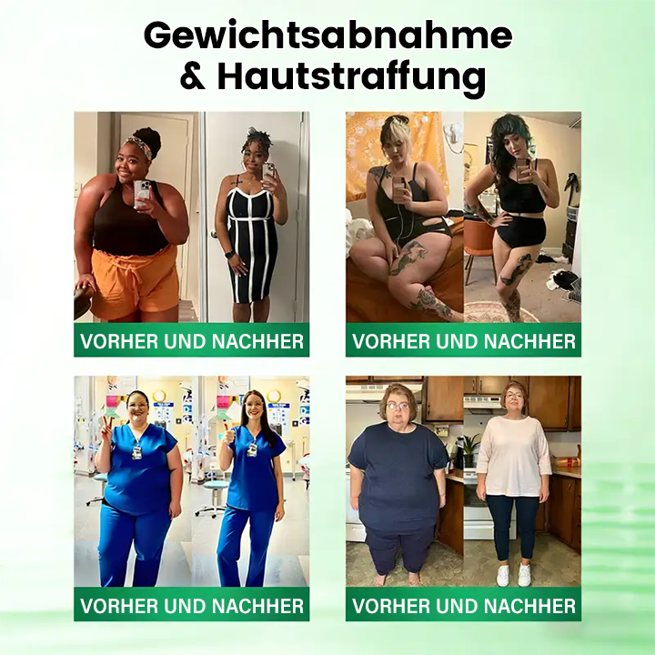 Offizieller Store | ☀️☀️ Timilk® Moringa · Berberin × NAD+ 10-in-1 Advanced Nano-Mikronadel-Patch(Nur einmal täglich anwenden – sichtbare Veränderungen in 7 Tagen)