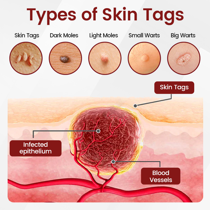 Ceoerty® KeraErase Black Rice Hauterneuernde Ampulle⭐