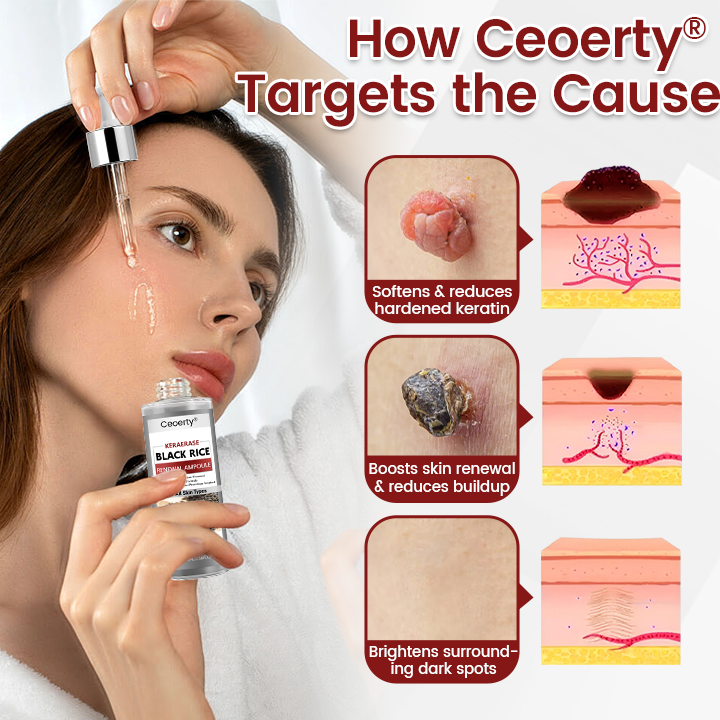 Ceoerty® KeraErase Black Rice Hauterneuernde Ampulle⭐