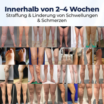 Timilk® SwellRelief Durchblutungsunterstützende Creme⭐