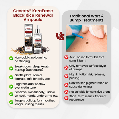 Ceoerty® KeraErase Black Rice Hauterneuernde Ampulle⭐