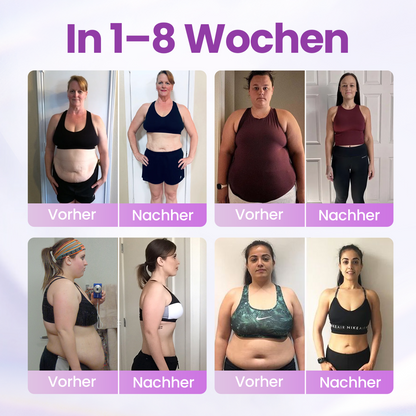 Timilk® Nano-Mikro-Delivery Slim Patch — Moringa · Berberin × NAD+ 10-in-1