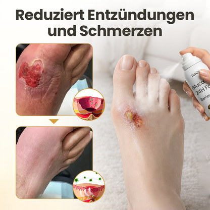 Timilk® GlucaVeil 24H Fuß-Barriere-Spray