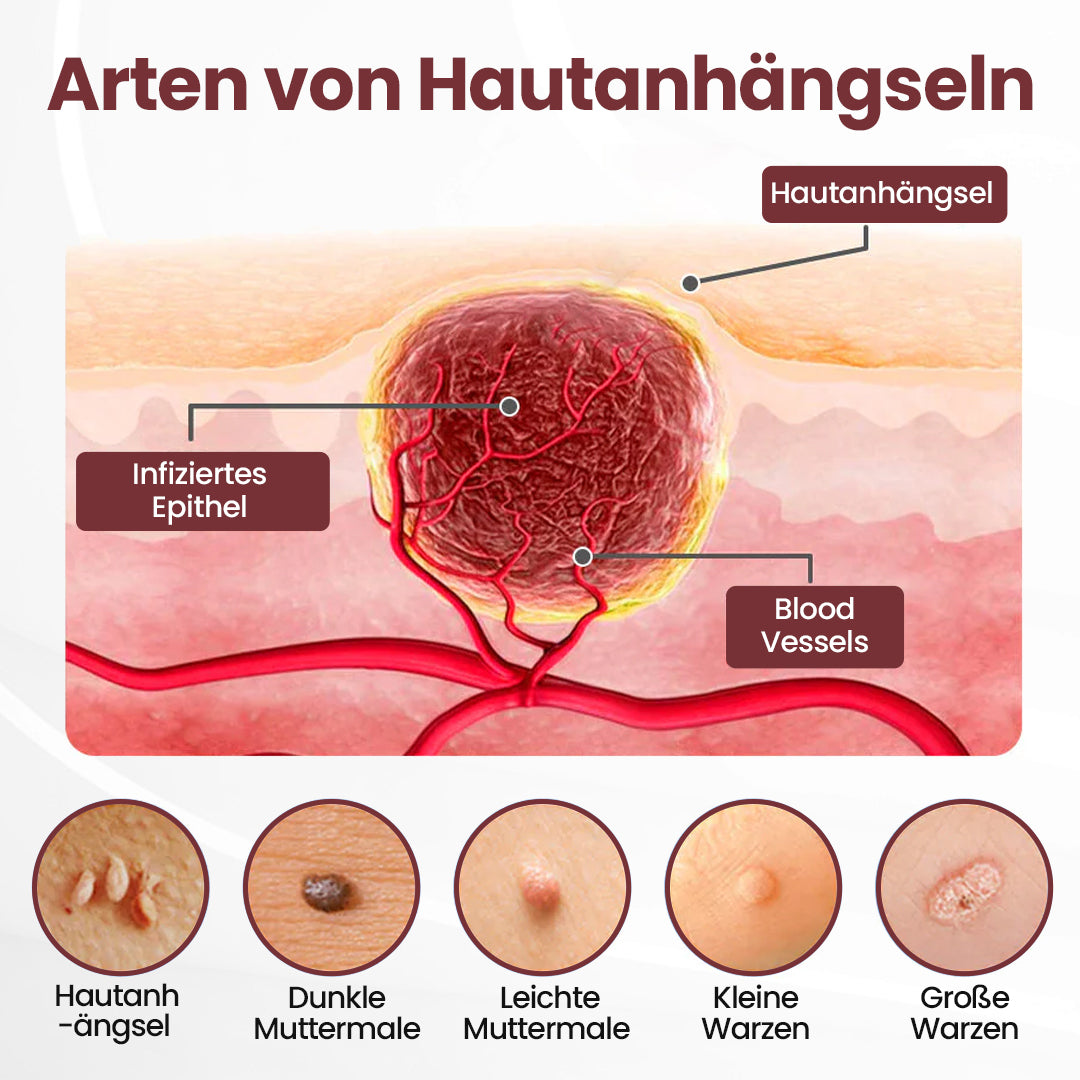 Biancat® KeraErase Dual-Action Erneuerungscreme⭐