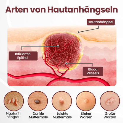 Biancat® KeraErase Dual-Action Erneuerungscreme⭐